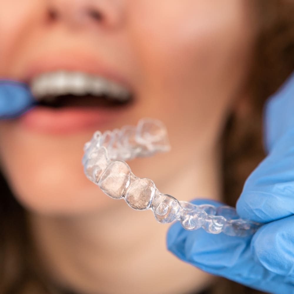 Invisalign Clear Aligners at Douglas Orthodontics